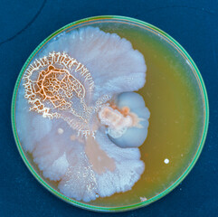 colonies of bacteria and microorganisms on the surface of agar and wind during microbiological...