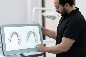 Skilled dentist showing lower and upper human jaws models on monitor presenting teeth treatment...