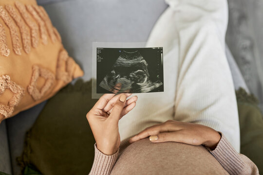 Top view closeup of pregnant young woman holding ultrasound picture of baby, copy space