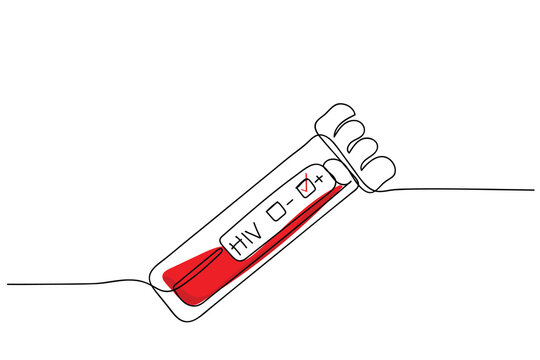 HIV AIDS medical test. Blood Syringe, research, analysis, medicine. Sample blood with HIV test label on HIV infection. Aids Awareness Red Ribbon. World AIDS Day Concept. Blood Vial. Banner design art.