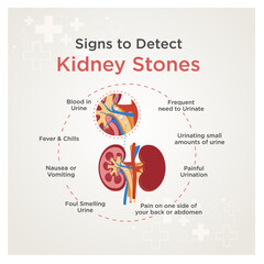 Kidney Stones. Kidney Health Signs. Medical and Health Care Poster Templates Vector 