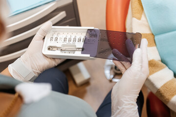 Fototapeta premium nurse prepares dental equipment, prepares for patient's arrival