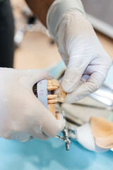 dentist shows the patient a model of the jaw and teeth