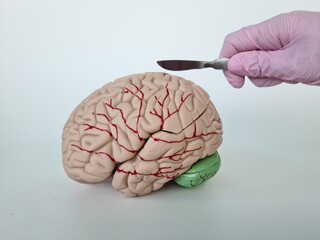 Surgeon hands are holding scalpel and model of human brain