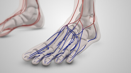 Obraz na płótnie Canvas Diabetic blood vessel damage in the feet 
