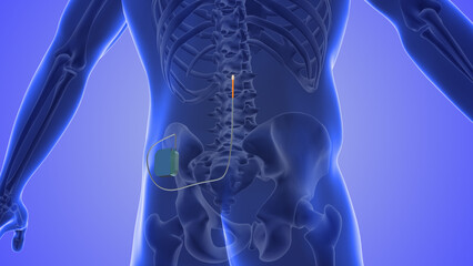 Spinal cord stimulation medical concept	