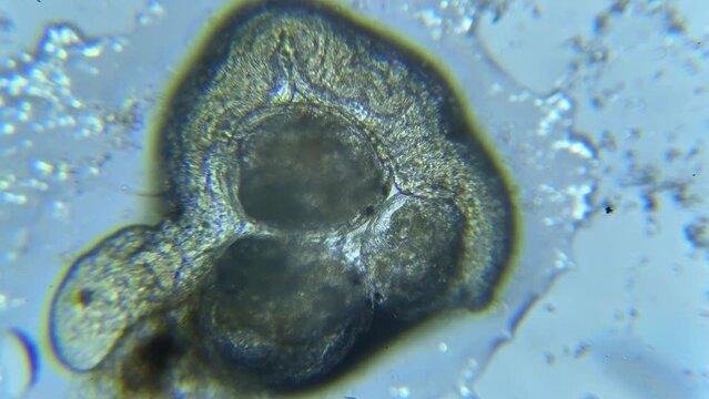 Survival in Scarcity: Aquatic Worm Encounters Three Water Fleas