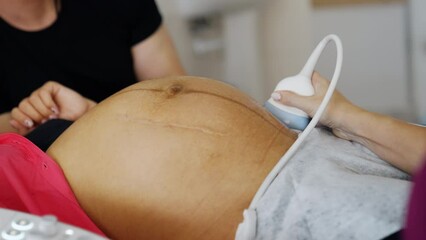 Doctor's hand moving ultrasound transducer by the big pregnant belly of an unrecognized woman. Checking the pregnancy on the last stages before baby delivery. - Powered by Adobe