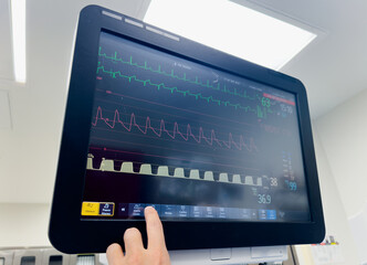 hospital monitor displaying vital signs: blood pressure, heart rate, pulse oximetry, and temperature, providing critical patient health data in a medical setting