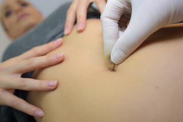 Closeup of belly button piercing