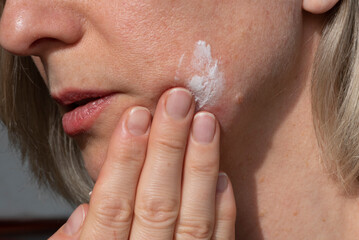 Applying cream to an adult woman's face for perfect skin. Concept of beauty and care for face and...