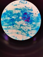 Mycobacterium tuberculocis bacteri seen through a microscope 