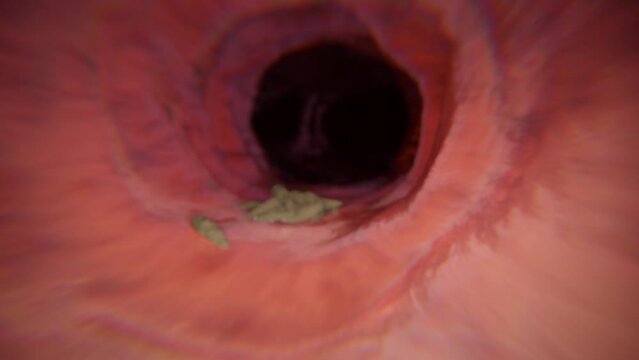 Exploration gastroscope - movie showcasing visualization of bacteria detection during examination