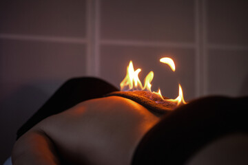 FIre massage alternative therapy. Wellness rehabilitation for patient in medical clinic office....