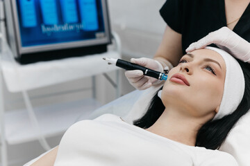 Shot of a beautiful young woman on a facial dermapen treatment at the beauty salon. Dermatologist...