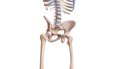 Intertrochanteric fracture on the femur head skeleton 3D medical illustration - obrazy, fototapety, plakaty
