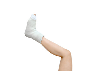 Fractured foot in a plaster cast on a white background. White plaster on the ankle, Insurance...