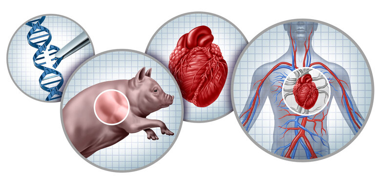 Pig donor To Human Heart Transplant concept as a genetically modified animal organ transferred to humans as Xenotransplantation technology or Xenogeneic transplantation