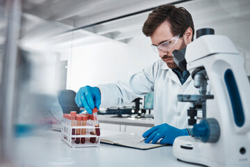 Working in laboratory, person studying chemical sample in blood test tube and research biotechnology in Germany. Expert pathology scientist, liquid solution and focus on career in medical science