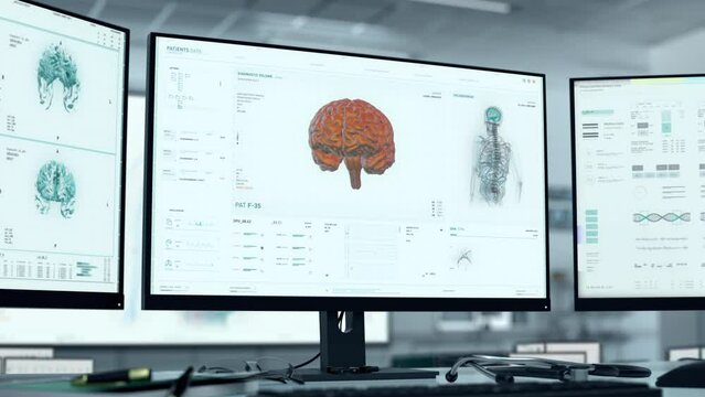 Modern technology analysis of the patients brain for medical therapy. Analysing the brain of the sick person for future therapy. Analysis software examining the brain tumor for cancer therapy.