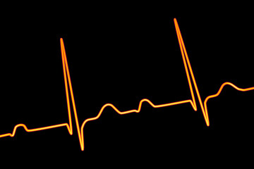An ECG displaying 1st degree AV block, 3D illustration