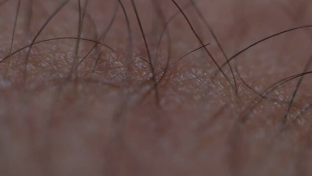 A macro shot from hair growing on the skin of a 40 years old male Brazilian