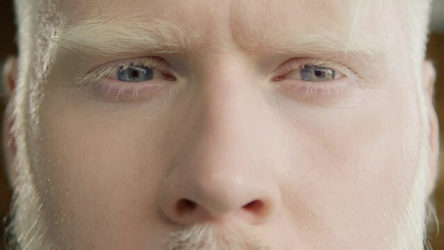 Close up of handsome albino male eyes. Concept of diversity, equality and people of different ethnicity and nationality. Calm relaxed man looking at camera. Male model with discolored hair pale skin