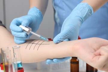 Doctor doing skin allergy test in clinic, closeup