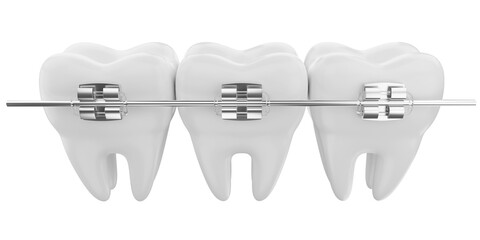 dental braces 3d icon - obrazy, fototapety, plakaty