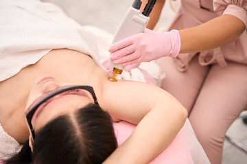Obraz na płótnie Canvas Specialist performs a procedure for laser hair removal of armpits