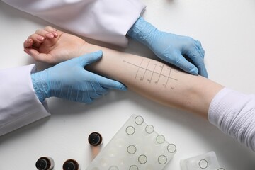 Doctor doing skin allergy test at light table, top view - obrazy, fototapety, plakaty
