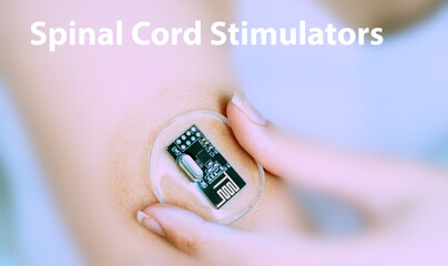 Spinal Cord Stimulators Implantable Electronic Medical Devices Concept - obrazy, fototapety, plakaty