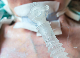Close up view of a tracheostomy tube in a adult woman neck.