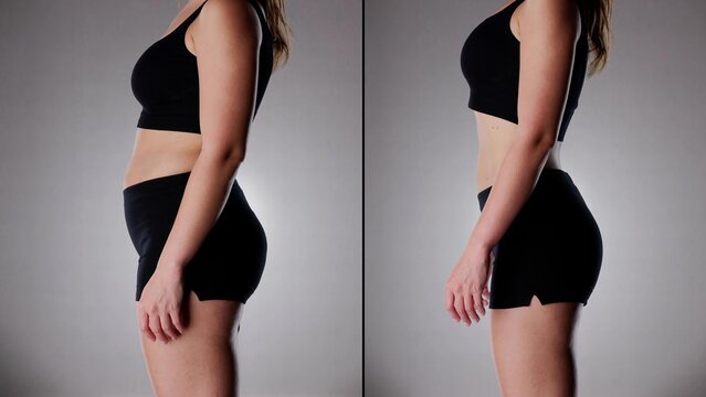Before After Weight Loss