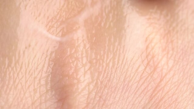 Close up of woman applying white serum on dry skin. Care for very dry skin. Serum lotion applied by a woman's hand, macro.  Skin care cosmetics, moisturizing gel.