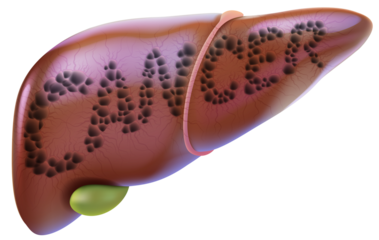3D illustration of the liver and gallbladder with the word cancer presented for quick understanding. For medical, educational, advertising, scientific and industrial use.