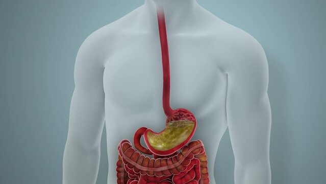 Acid Reflux Disease GERD 3D Animation