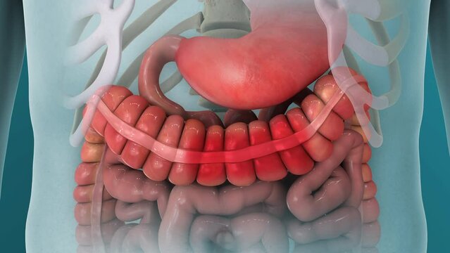 IBS Irritable Bowel Syndrome Pain Cramps 3D Animation