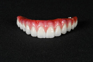 high-quality dental prosthesis for the upper jaw with a pink gum on a black background © Umutcan