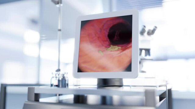 Exploration using gastroscope equipment - film showcasing visualization of bacteria detection during examination