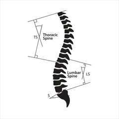 Spinal-pelvic sagittal parameters Line art vector illustration - obrazy, fototapety, plakaty