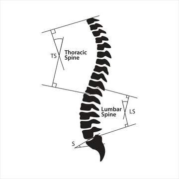 Spinal-pelvic sagittal parameters Line art vector illustration