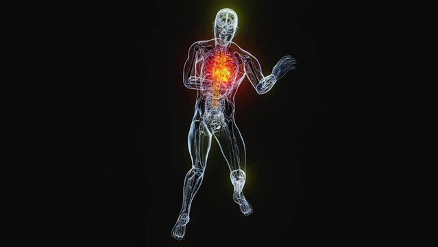 Abstract animation of a heart attack