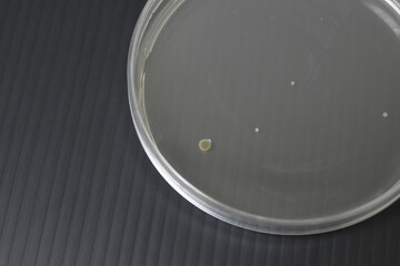 Colonies of bacteria growth on agar plate medium in laboratory.