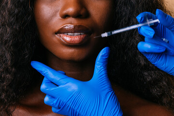 Beauty portrait of beautiful black woman getting filler in the lips with injection
