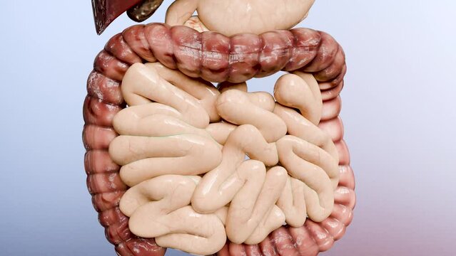 Colorectal cancer, malignant tumor in intestine, Endoscope inside colonoscopy, gut intestine, Colon polyp removal, colonic polyps search, Polypectomy, intestinal carcinoma, bowel neoplasia, 3d render