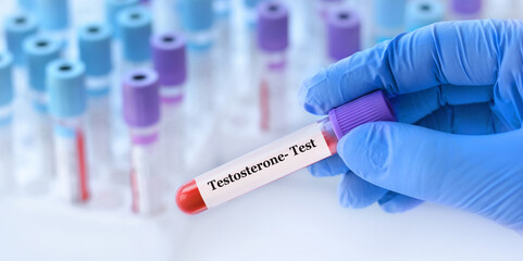 Doctor holding a test blood sample tube with Testosterone test on the background of medical test tubes with analyzes - obrazy, fototapety, plakaty