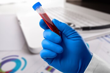 Blood tubes of patient and medical test report - obrazy, fototapety, plakaty