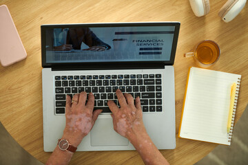 Hands of senior woman with vitiligo working on laptop visiting financial services website