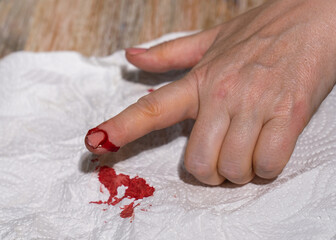 A woman's hand with a cut finger, bleeding heavily.